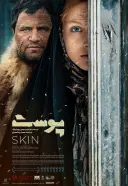 پوست 1397