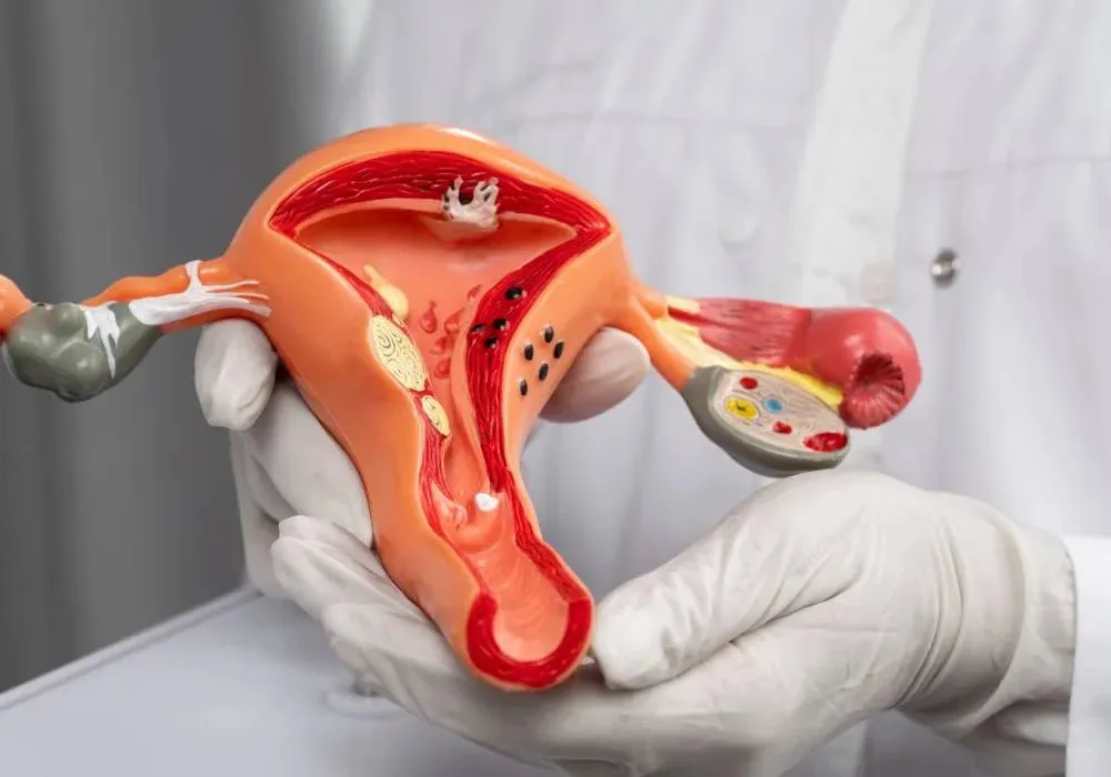 واژینوپلاستی در تهران